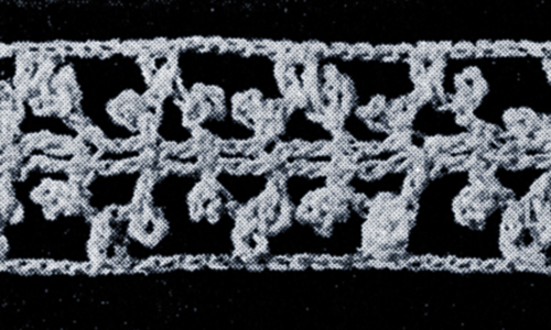Irish Beauty Insertion Pattern #1801